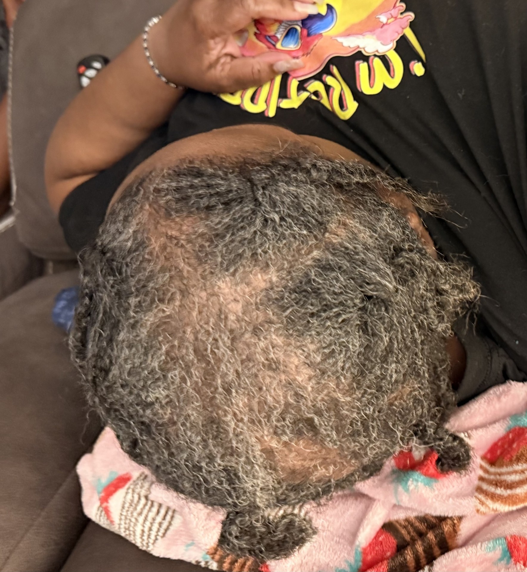 Patrice after