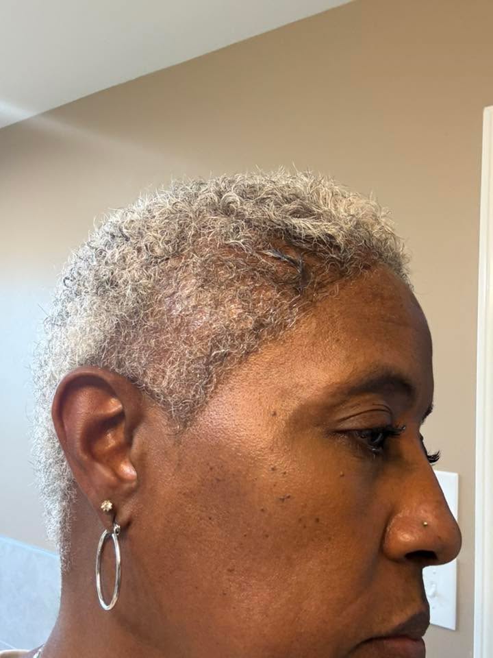 Denise before