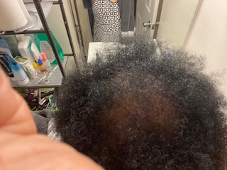 After 12 weeks — customer hair transformation