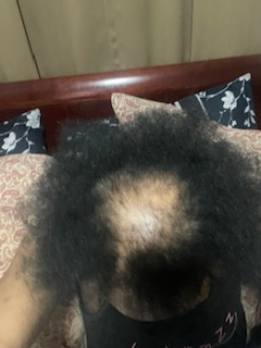 Before — customer hair transformation