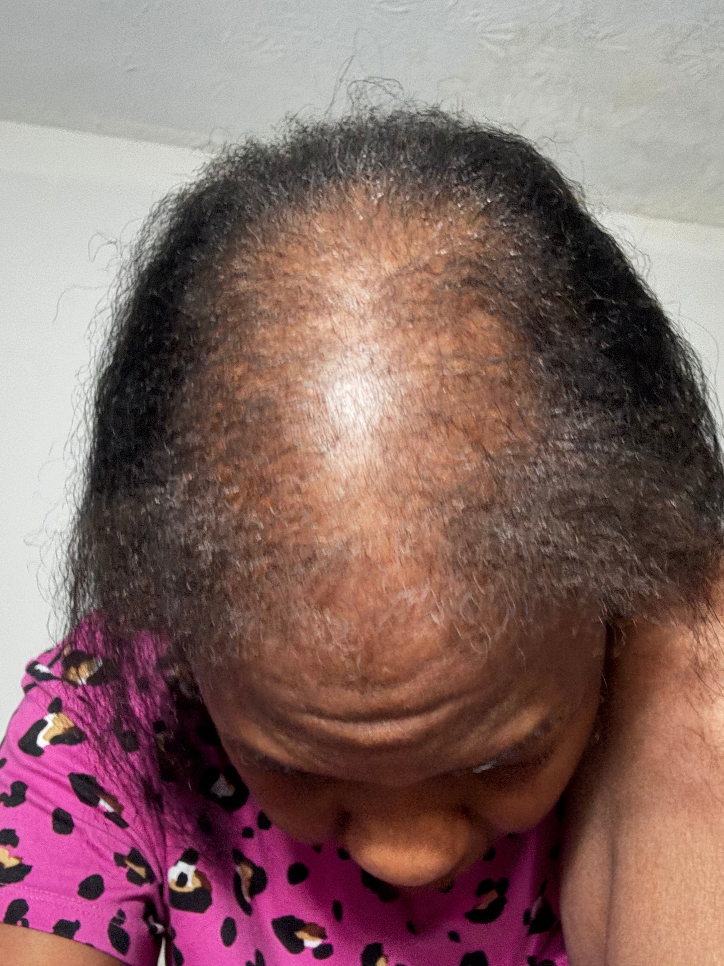 Yvette before
