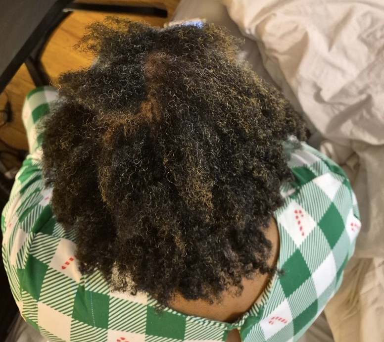 Shalane after